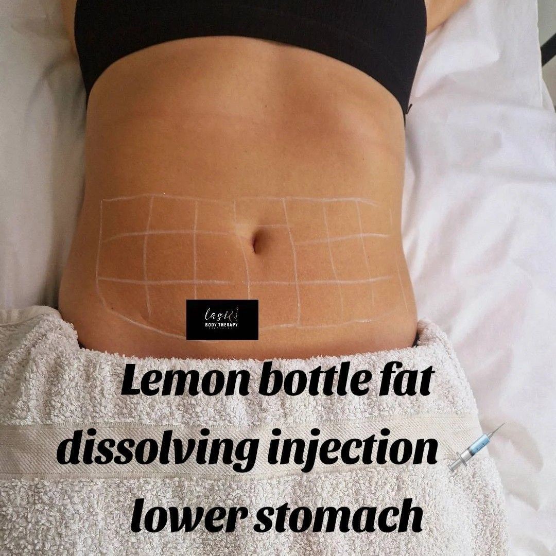 lemon bottle fat dissolving injection